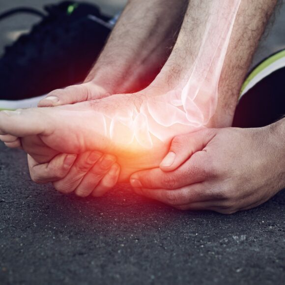 Fascite Plantar