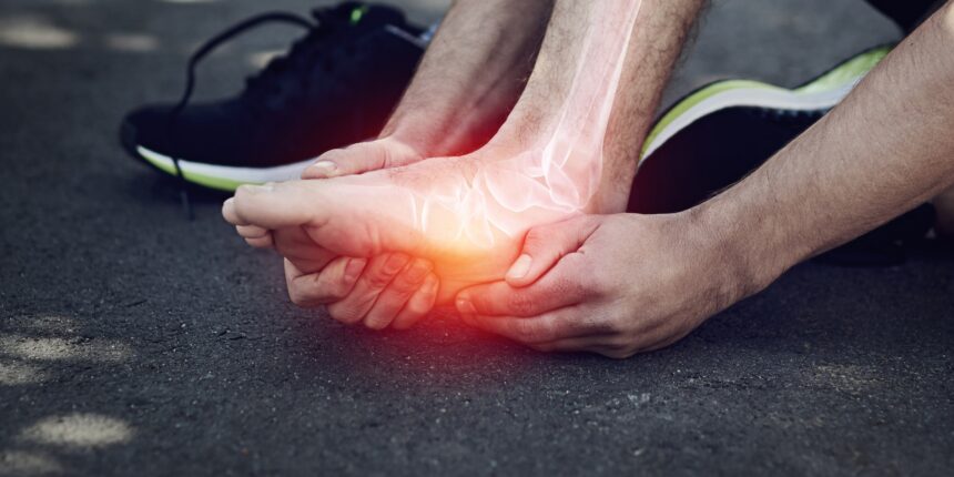 Fascite Plantar
